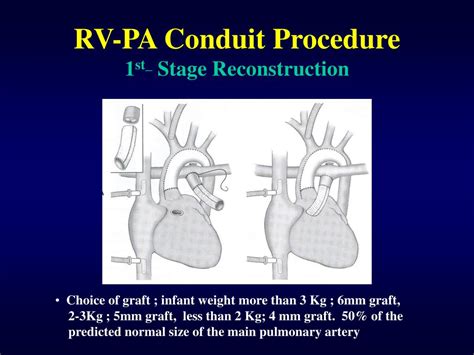 rv pa conduit repair.